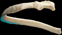 <p>Identify the structure</p>