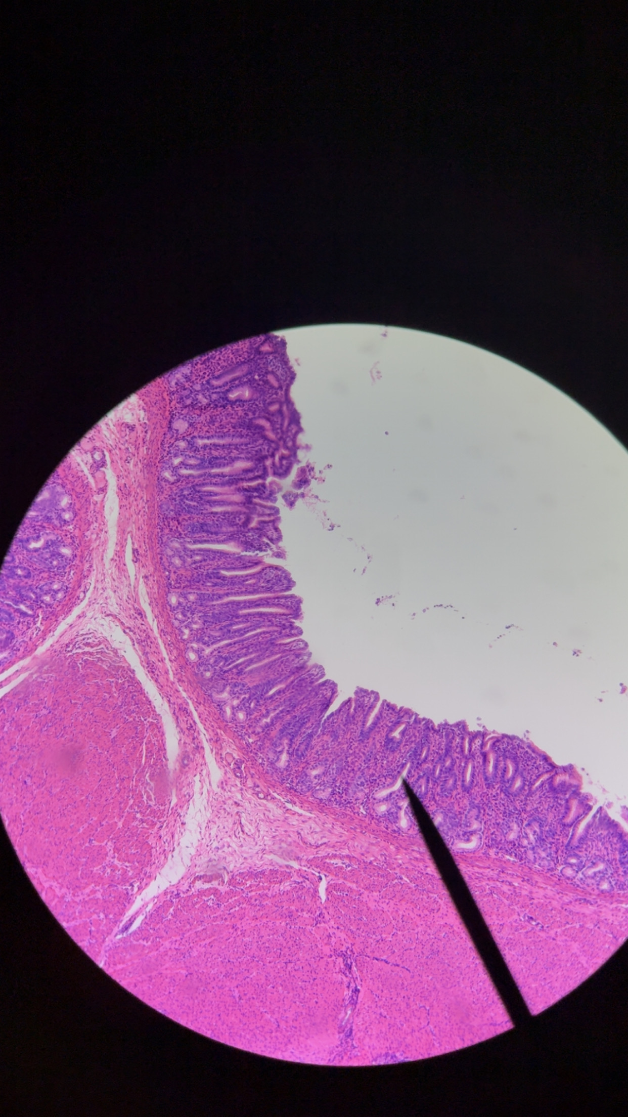 <p>pyloric stomach  - 3 </p>