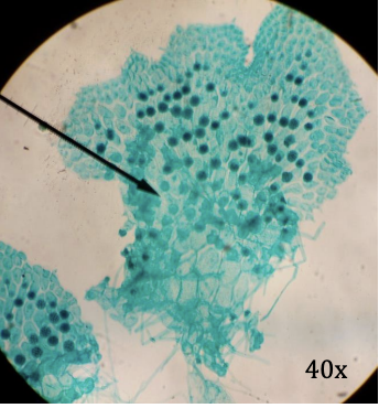 <p>Kingdom:  </p><p>Phylum: </p><p>Name of Structure: </p><p>Ploidy: </p>
