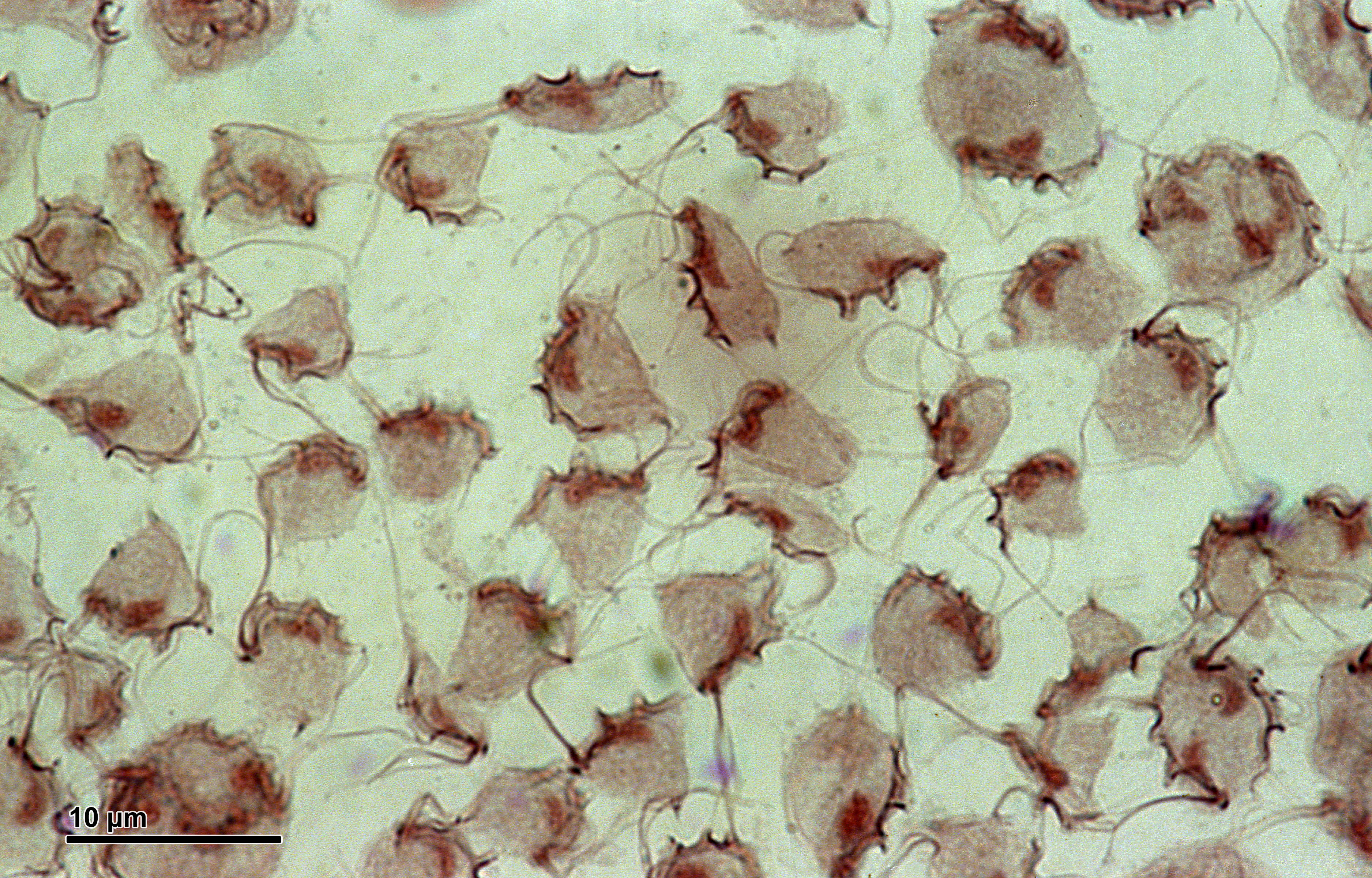 <p>Tritrichomonas (foetus)</p>