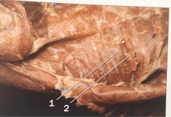 <p>muscles that serve to draw the ribs together during respiration</p>