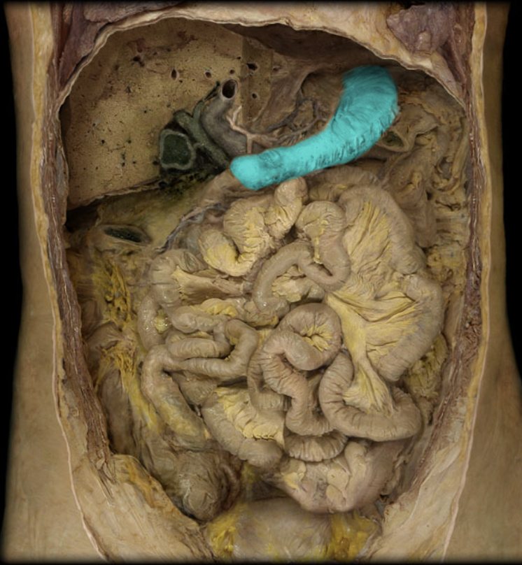 term image
