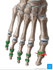 <p>Name Joint</p>