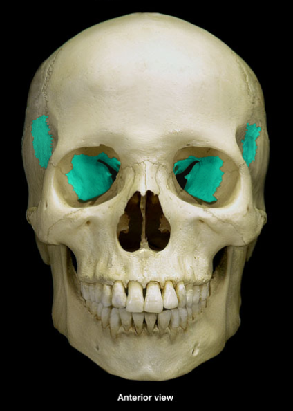 <p>What is the name of this bone?</p>