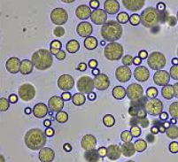<p>Calcium Carbonate Crystals</p>