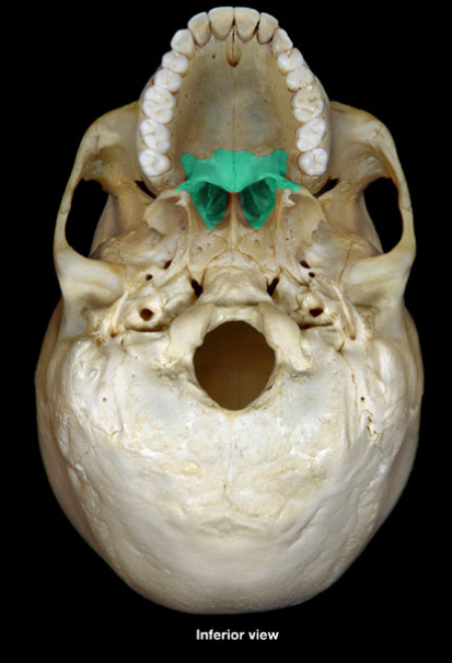 <p>What is the name of this structure?</p>