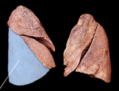 <p>Identify the structure</p>