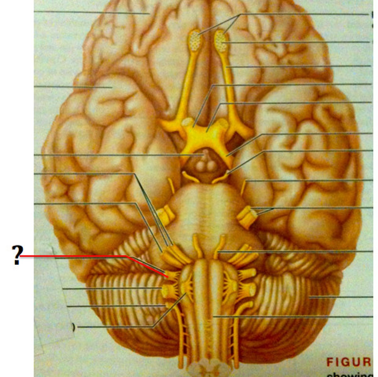 <p>Function: Both</p><p>Sensory-Taste, respiration, blood pressure</p><p>Motor- Swallowing & gagging</p><p>Exit: Jugular foramen</p>