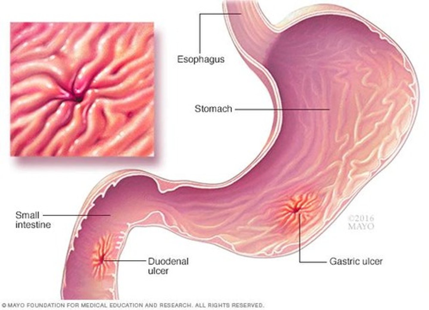 <p>Enzymes and hydrochloric acid that aid in food digestion</p>