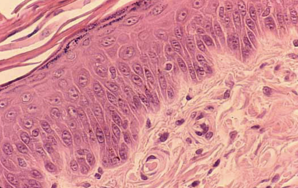 <ol><li><p>Sickle Cell Anemia</p></li><li><p>Atherosclerosis</p></li><li><p>Adenocarcinoma of Kidney</p></li><li><p>Osteogenic Sarcoma of Bone</p></li><li><p>Tattoo in Human Skin</p></li><li><p>Neurilemmoma</p></li><li><p>Anthracosis of the Lung</p></li><li><p>Basal Cell Carcinoma</p></li><li><p>Lung</p></li><li><p>Skeletal</p></li><li><p>Kidney</p></li><li><p>Neuron</p></li><li><p>Skin</p></li><li><p>Blood</p></li><li><p>Bone</p></li><li><p>Aorta</p></li></ol><p></p>