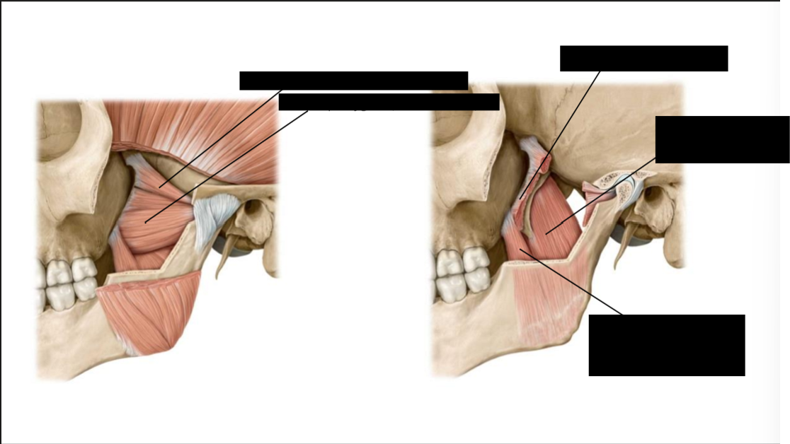 <p>Label these muscles of mastication</p>