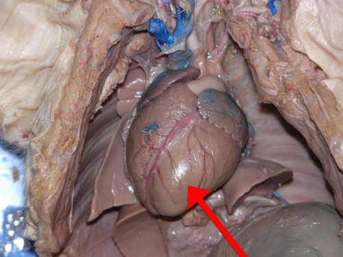 <p><span>Left Ventricle</span></p>