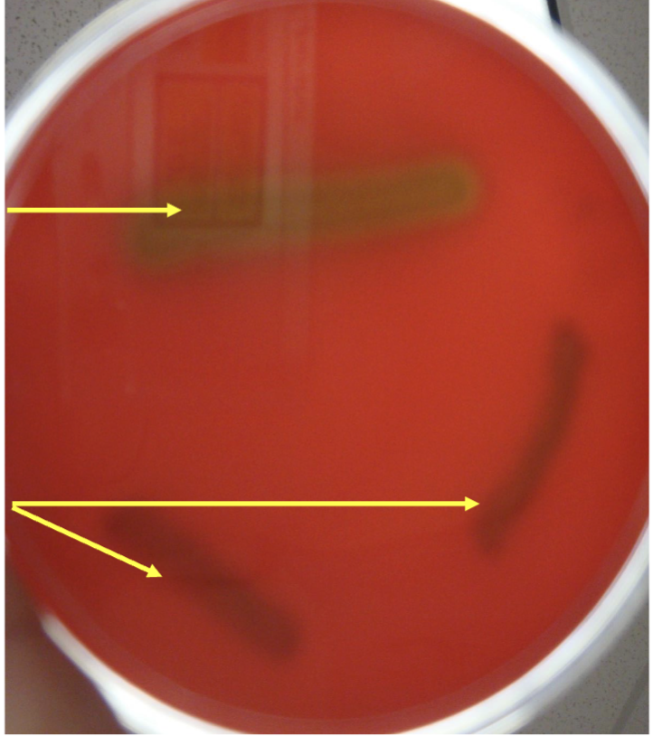 <p>what is top arrow?</p>