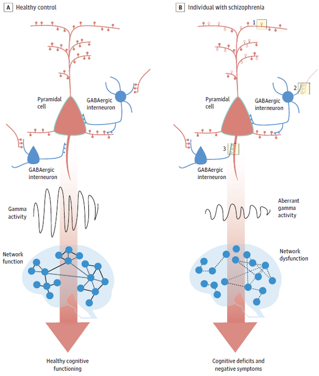 <p>corticale excitatie–inhibitie disbalans</p><p>1) Verlies ; <strong>spines </strong>van piradimale cellen » <strong>minder </strong>excitatorische reactie</p><p>2) » <strong>minder </strong>input in GABAergic interneuronen → <strong>minder inhibitie </strong>van piradimale cellen</p><p></p><p>Dit leidt vervolgens tot <strong>afwijkende </strong>gamma activiteit en dyfunctionele netwerken → <strong>negatieve symptomen en verminderde cognitie</strong></p>