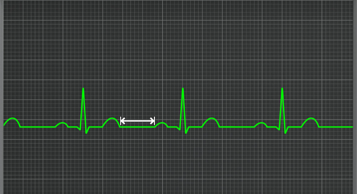 <p>what segment is this</p>