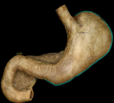 term image