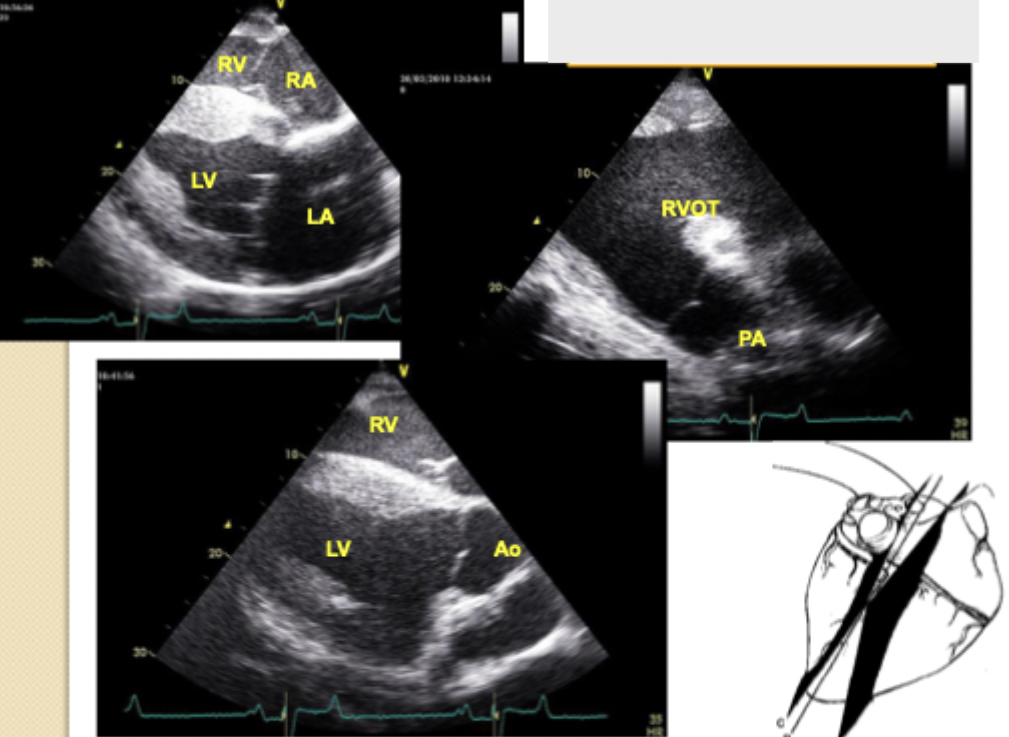 <p>What view of echocardiogram is this? </p>