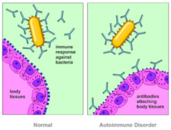 <ul><li><p>the immune system is attacking normal cells of the body</p></li></ul><p></p>