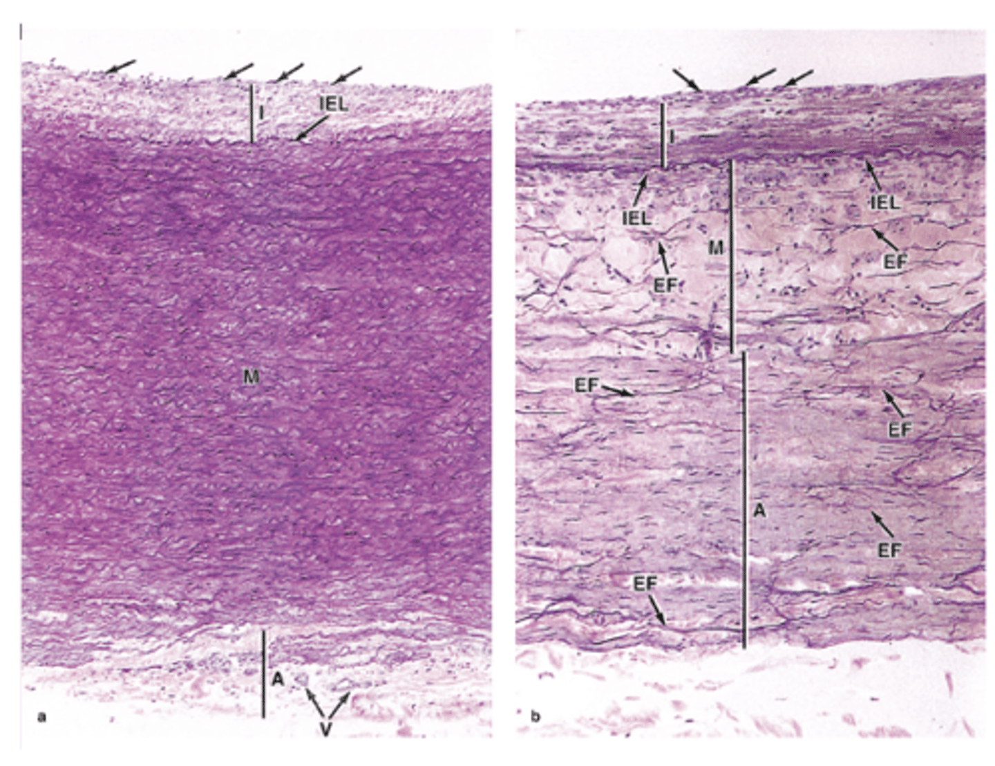 <p>How are smooth muscle fibers arranged in the tunica media?***</p>