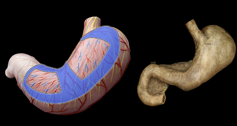 term image