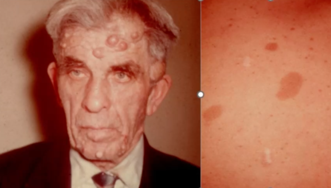 <p>what is the diagnosis of this condition </p>