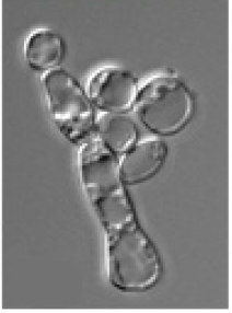 <p>Creates a 3D like image with a flat specimen by utilizing nomarski prisms to spit the light into 2 beams, travel along the cell, and rejoin into a singular beam to create specific contrasts and shadows </p>