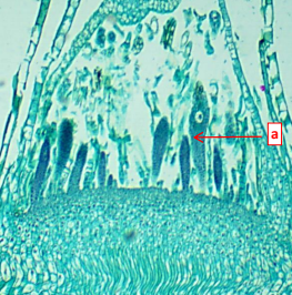 <p>This is a moss __________ (female gametangium).</p>