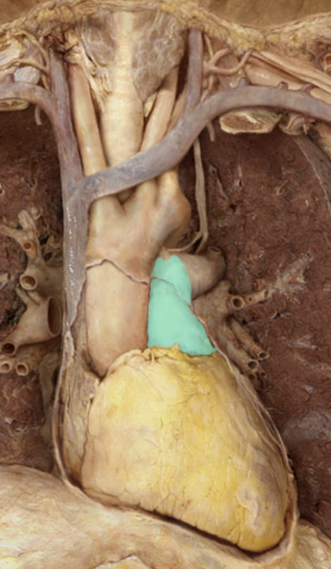 <p>Identify the feature of the heart</p>