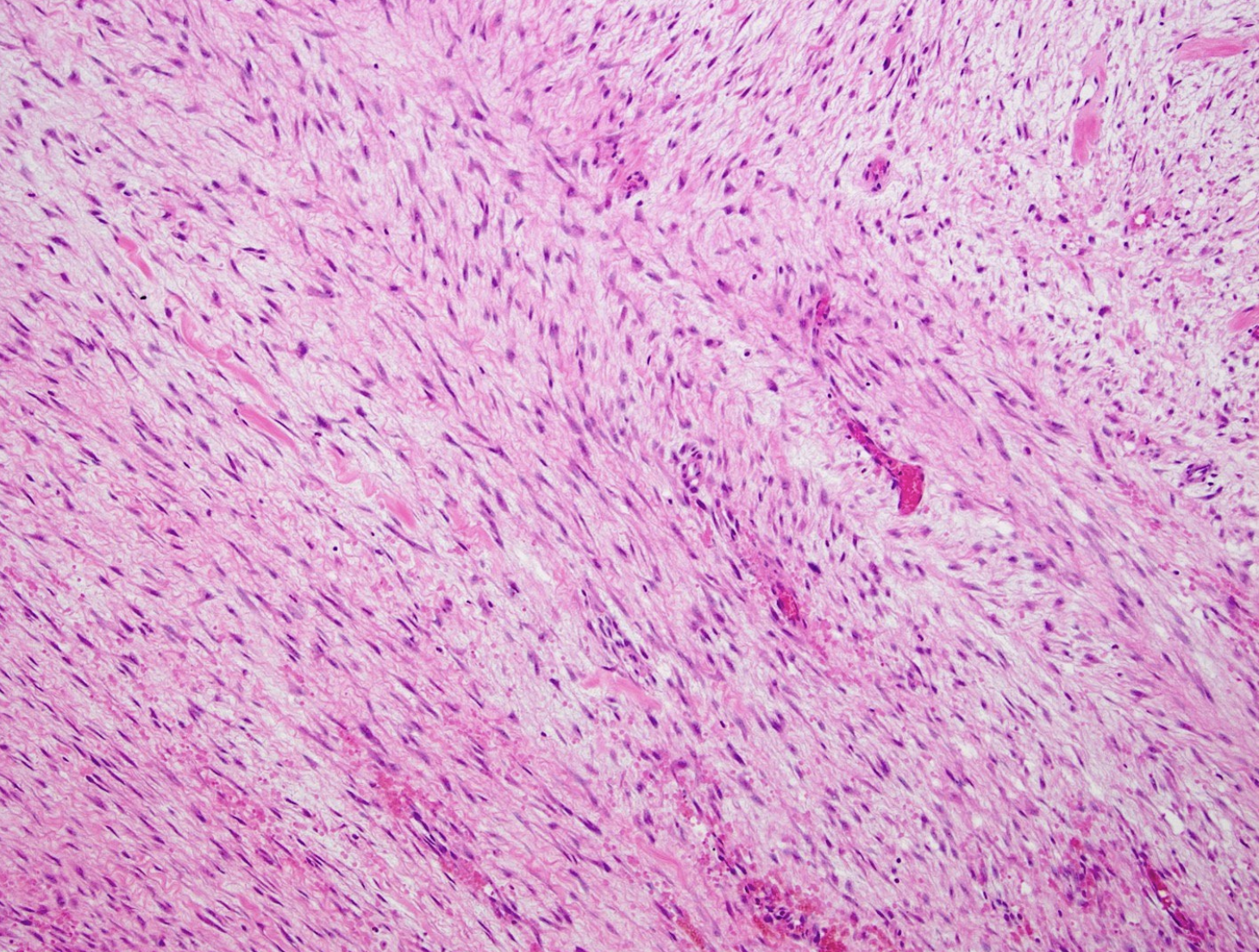 <p>tumeur de la mandibule</p><p>diagnostic</p><p>définition</p><p>age</p><p>anatomie</p><p>histologie</p><p>IHC</p><p>moléculaire</p><p>syndrome </p>