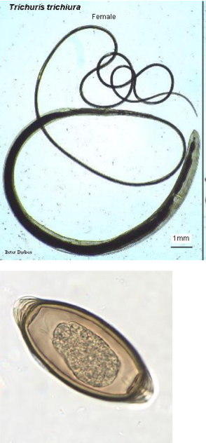 <ul><li><p>first image is adult form and second is egg </p></li><li><p>whipworm </p></li><li><p>Trichuriasis<span> (Whipworm infection)</span></p></li></ul><p></p>
