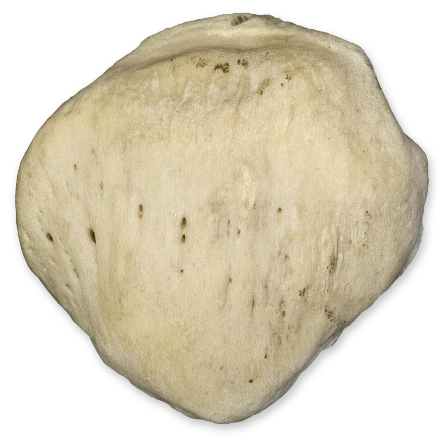 <p>What detached bone is this?</p>