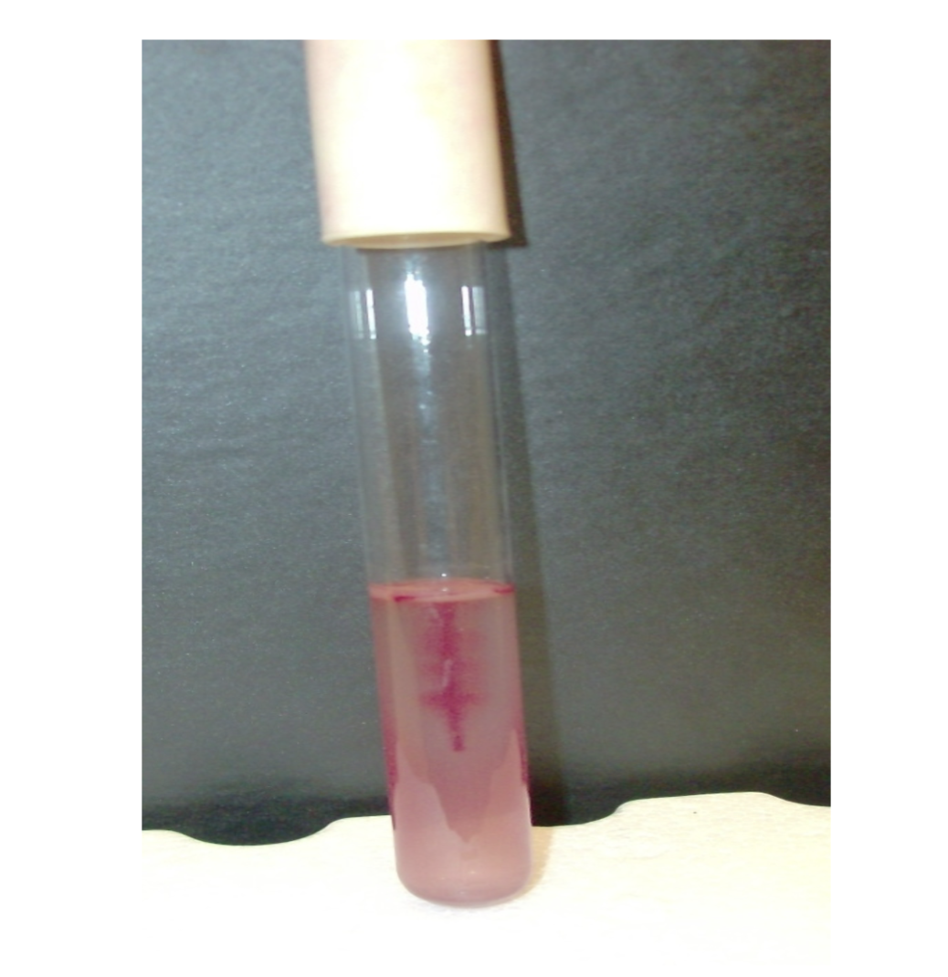 <p>what is the test and result?</p>