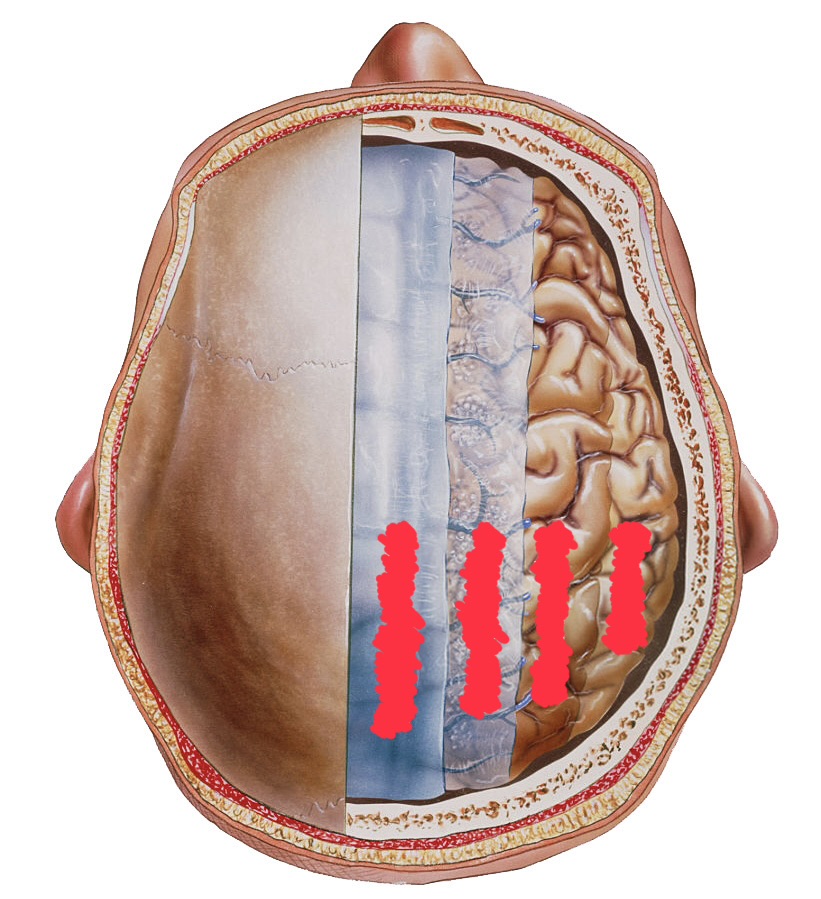 <p>popíš obaly CNS</p>