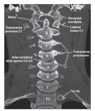 <p>What spinal stuctures are best visualized in the coronal plane?</p>