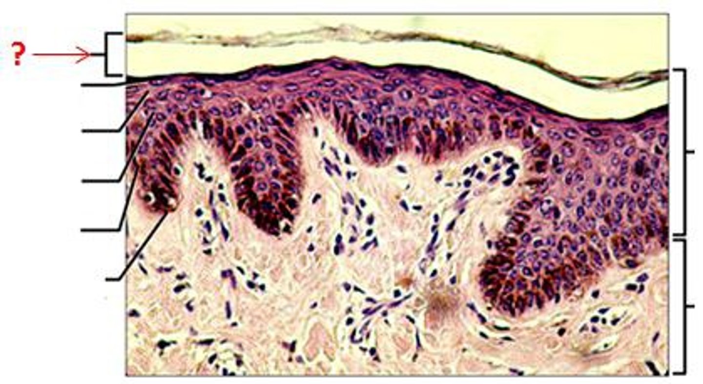 <p>outermost layer of the epidermis, which consists of flattened, keratinized (dead) cells</p>