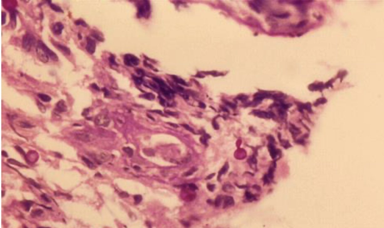 <p>Disease and pathogen </p>