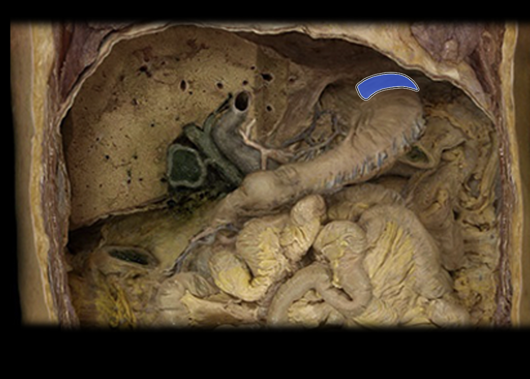 <p>Fundus</p>