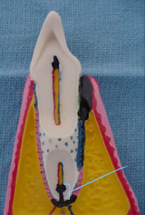 <p>This structure is the </p>