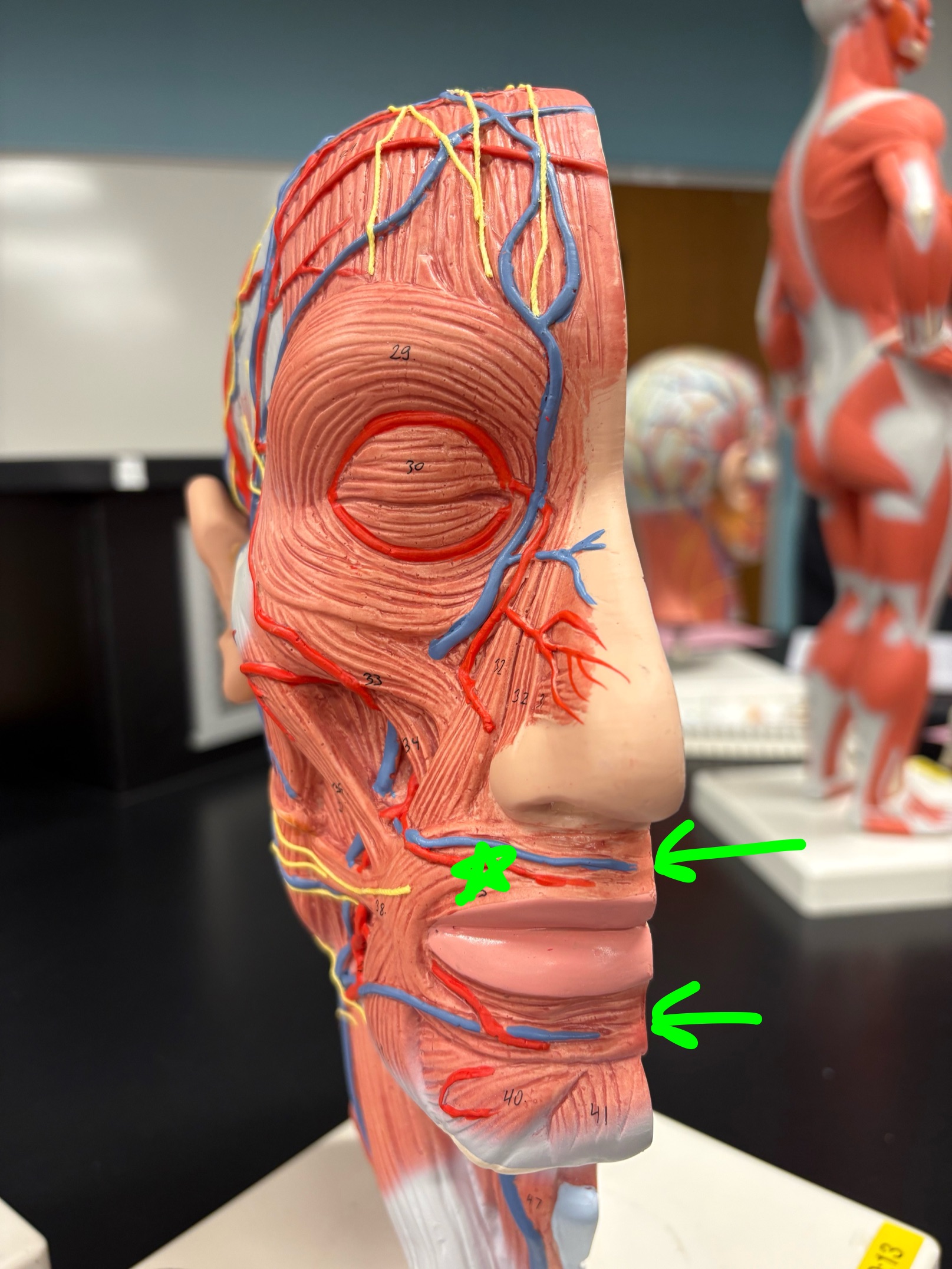 <p>Name the muscle.</p>