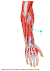 <p>Identify the indicated muscle.</p>