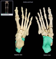 <p>Heel of the foot</p>