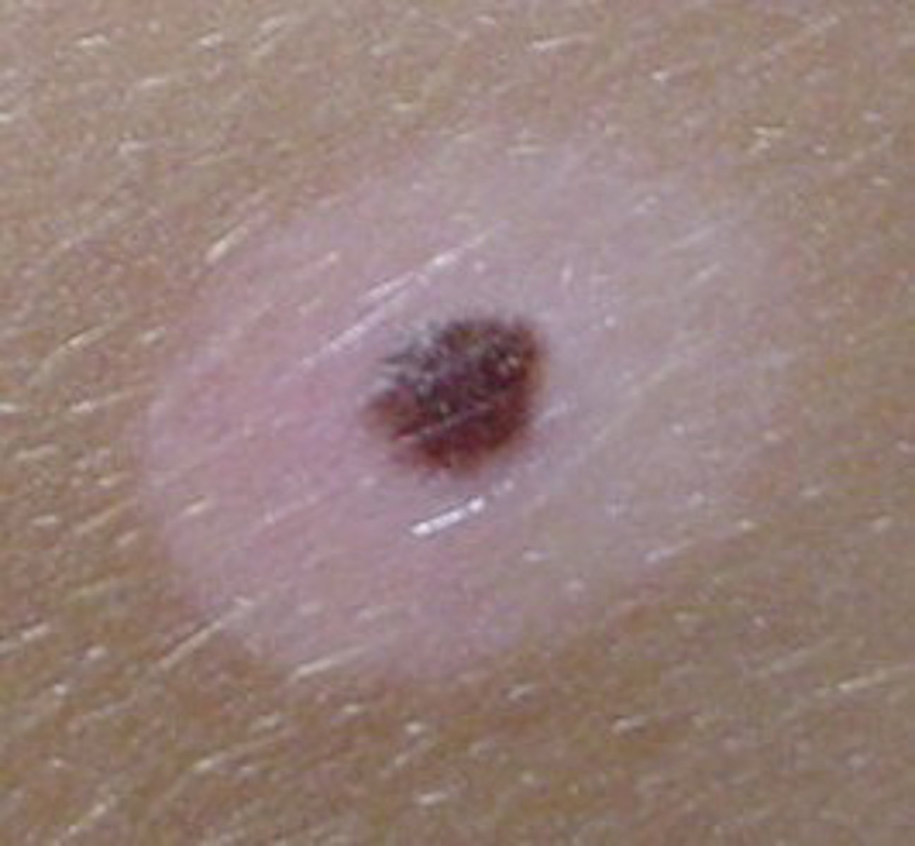 <p>mole</p>