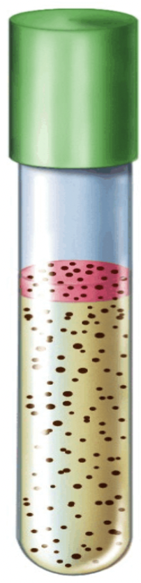 <p>Bacteria that are __________ can grow with or without oxygen. So they have even growth throughout the entire tube. The blue layer will always be there.</p>