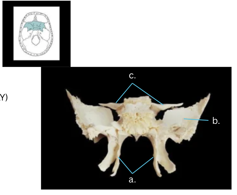 <p>Bone:</p><p>Sphenoid Bone</p><p></p><p>Structures:</p><p>Pterygoig plates (legs)</p><p>Greater wing</p><p>Lesser wing</p>