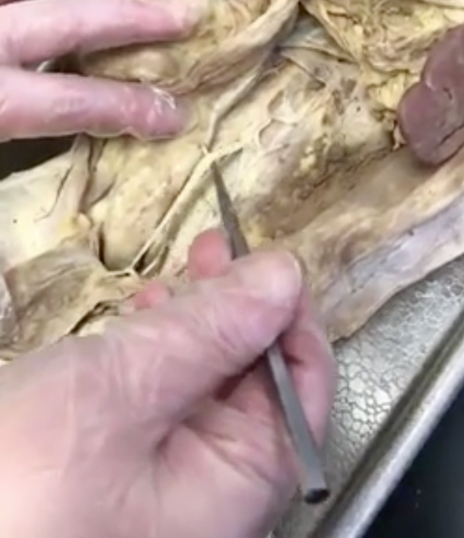<p>what is prong touching</p>