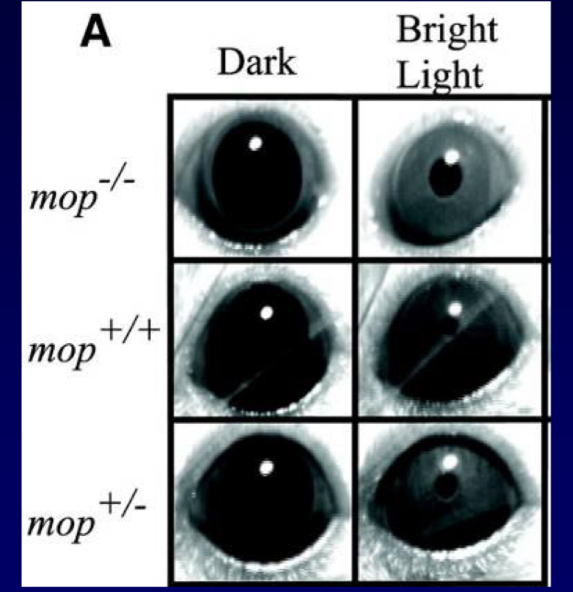 <p>pupillary response</p>