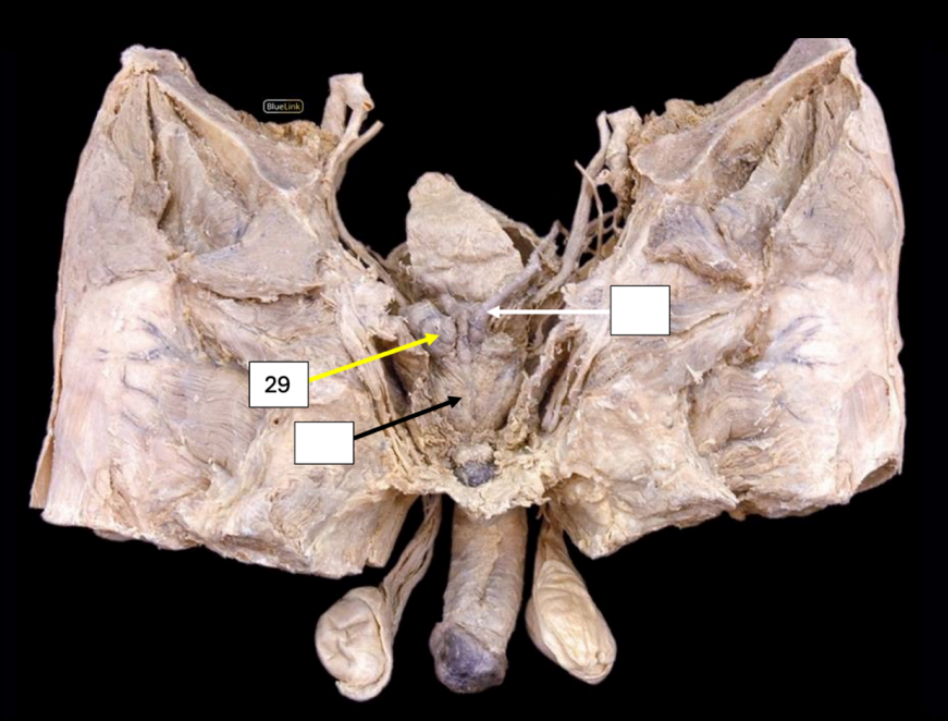 <p>Identify</p><p>Side Question:</p><p>These lie at the base of which structure?</p><p>Produces which secretion?</p><p>Structure found medially?</p><p>Structure found posteriorly?</p><p>Structure found inferiorly?</p><p>NVS?</p>