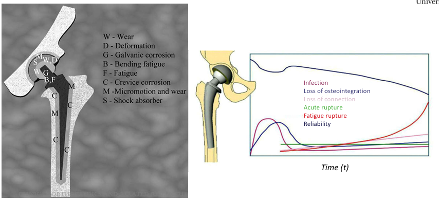 <p>W=wear</p><p>D=deformation</p><p>G=Galvanic corrosion</p><p>B=bending fatigue</p><p>C=crevice corrosion</p><p>M=micromotion and wear</p><p>S=shock absorber</p>