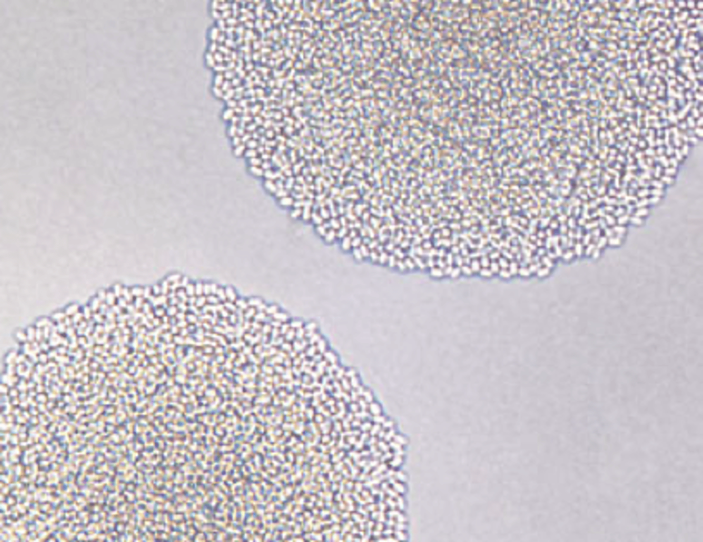<p>No pseudohyphae</p><p>Small blastoconidia with single terminal bud</p>