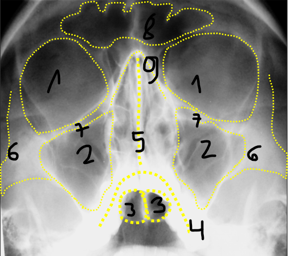 term image